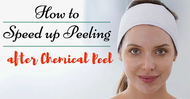 How to Speed Up Peeling After Chemical Peel