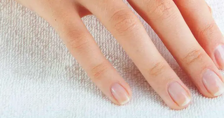 what-vitamin-deficiency-causes-nails-to-peel-by-duskyskin