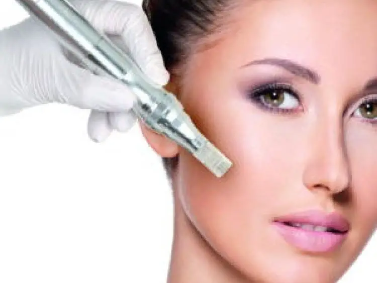 What to do After Microneedling?