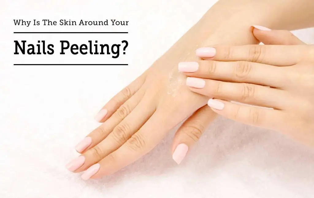 What Causes Skin Under Nails to Peel?
