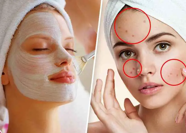 How to remove black spots caused by bleaching? 9 Best Methods