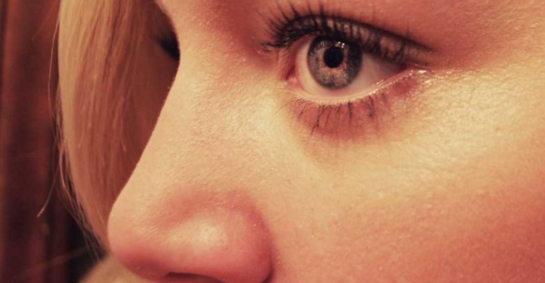 what-causes-yellow-spots-on-the-skin-15-real-facts